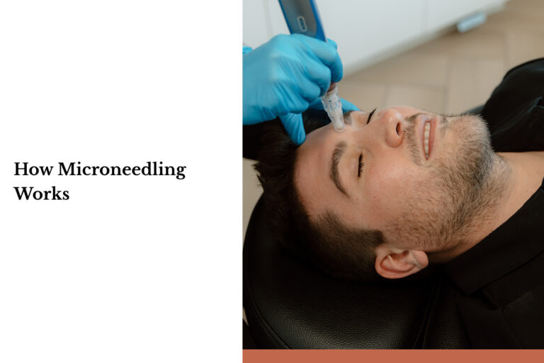 A man lies on a table and smiles as he undergoes microneedle treatment. Form Aesthetics is committed to helping you look your best.